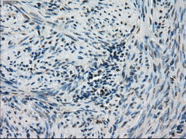 STK39 / SPAK Antibody - Immunohistochemical staining of paraffin-embedded endometrium tissue using anti-STK39 mouse monoclonal antibody. (Dilution 1:50).
