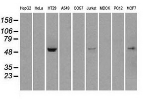 STK39 / SPAK Antibody - Western blot analysis of extracts (35ug) from 9 different cell lines by using anti-STK39 monoclonal antibody.