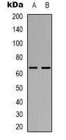 STK39 / SPAK Antibody - Western blot analysis of SPAK expression in Jurkat (A); HepG2 (B) whole cell lysates.