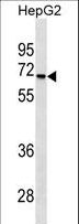 STK39 / SPAK Antibody - STK39 Antibody western blot of HepG2 cell line lysates (35 ug/lane). The STK39 antibody detected the STK39 protein (arrow).