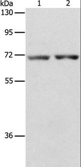 STK39 / SPAK Antibody - Western blot analysis of Human liver cancer and colon cancer tissue, using STK39 Polyclonal Antibody at dilution of 1:800.