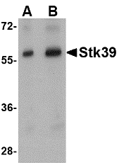 STK39 / SPAK Antibody - Western blot of Stk39 in rat brain tissue lysate with Stk39 antibody at (A) 1 and (B) 2 ug/ml