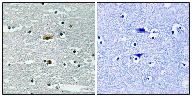 STK39 / SPAK Antibody - Immunohistochemistry analysis of paraffin-embedded human brain, using STK39 (Phospho-Ser311) Antibody. The picture on the right is blocked with the phospho peptide.
