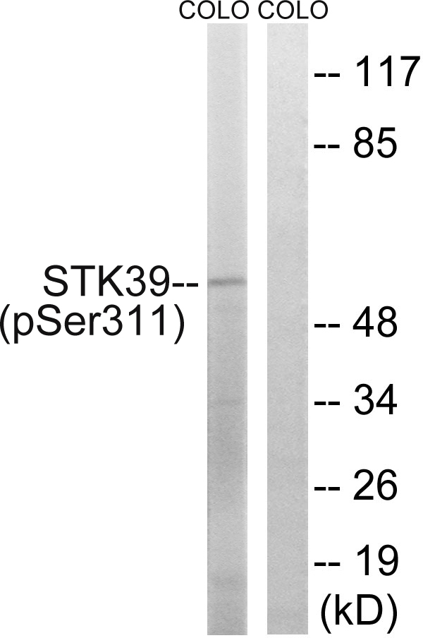 STK39 / SPAK Antibody - Western blot analysis of lysates from COLO205 cells, using STK39 (Phospho-Ser311) Antibody. The lane on the right is blocked with the phospho peptide.