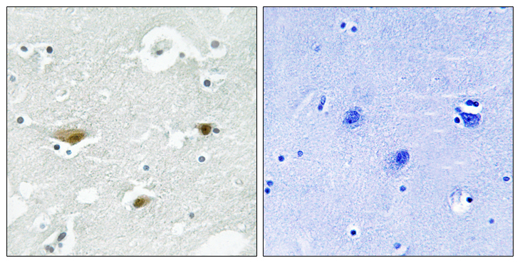 STK39 / SPAK Antibody - Immunohistochemistry analysis of paraffin-embedded human brain, using STK39 (Phospho-Ser325) Antibody. The picture on the right is blocked with the phospho peptide.
