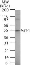 STK4 Antibody - Western blot of MST-1 in 15 ugs of Jurkat cell lysate using antibody at 1 ug/ml.