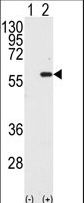 STK4 Antibody - Western blot of STK4 (arrow) using MST1 Antibody. 293 cell lysates (2 ug/lane) either nontransfected (Lane 1) or transiently transfected with the STK4 gene (Lane 2) (Origene Technologies).
