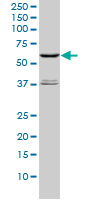 STK4 Antibody - STK4 monoclonal antibody (M01), clone 1D7-8A10 Western blot of STK4 expression in HeLa NE.
