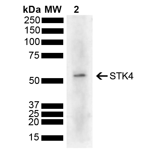 STK4 Antibody - Western blot analysis of Human Cervical cancer cell line (HeLa) lysate showing detection of 55.6 kDa STK4 protein using Rabbit Anti-STK4 Polyclonal Antibody. Lane 1: Molecular Weight Ladder (MW). Lane 2: HeLa. Load: 10 µg. Block: 5% Skim Milk powder in TBST. Primary Antibody: Rabbit Anti-STK4 Polyclonal Antibody  at 1:1000 for 2 hours at RT with shaking. Secondary Antibody: Goat Anti-Rabbit IgG: HRP at 1:5000 for 1 hour at RT. Color Development: ECL solution for 5 min at RT. Predicted/Observed Size: 55.6 kDa.