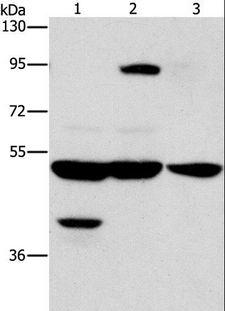 STK4 Antibody - Western blot analysis of Human bladder carcinoma tissue and A172 cell, human brain malignant glioma tissue, using STK3/STK4 Polyclonal Antibody at dilution of 1:1000.