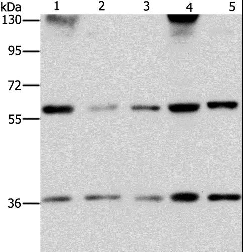 STK4 Antibody - Western blot analysis of PC3 and HeLa cell, human bladder carcinoma tissue and A172 cell, hepG2 cell, using STK3/STK4 Polyclonal Antibody at dilution of 1:1000.