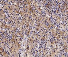 STK4 Antibody - 1:100 staining human lymph node tissue by IHC-P. The tissue was formaldehyde fixed and a heat mediated antigen retrieval step in citrate buffer was performed. The tissue was then blocked and incubated with the antibody for 1.5 hours at 22°C. An HRP conjugated goat anti-rabbit antibody was used as the secondary.