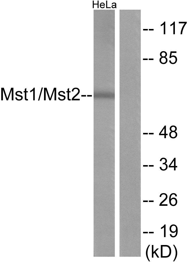 STK4 Antibody - Western blot analysis of extracts from Jurkat cells, treated with UV (15mins), using Mst1/2 (Ab-183) antibody.