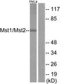 STK4 Antibody - Western blot analysis of extracts from Jurkat cells, treated with UV (15mins), using Mst1/2 (Ab-183) antibody.