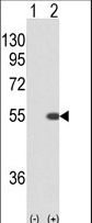 STK40 Antibody - Western blot of STK40 (arrow) using rabbit polyclonal STK40. 293 cell lysates (2 ug/lane) either nontransfected (Lane 1) or transiently transfected with the STK40 gene (Lane 2).