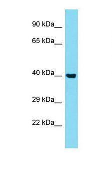 STK40 Antibody - Western blot of Human A549 . STK40 antibody dilution 1.0 ug/ml.  This image was taken for the unconjugated form of this product. Other forms have not been tested.