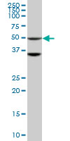 STK40 Antibody - STK40 monoclonal antibody (M04), clone 4G3. Western blot of STK40 expression in HepG2.