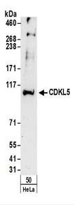 STK9 / CDKL5 Antibody - Detection of Human CDKL5 by Western Blot. Samples: Whole cell lysate (50 ug) from HeLa cells. Antibodies: Affinity purified rabbit anti-CDKL5 antibody used for WB at 0.4 ug/ml. Detection: Chemiluminescence with an exposure time of 3 minutes.
