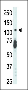 STK9 / CDKL5 Antibody - The anti-STK9 antibody is used in Western blot to detect STK9 in mouse lung tissue lysate.