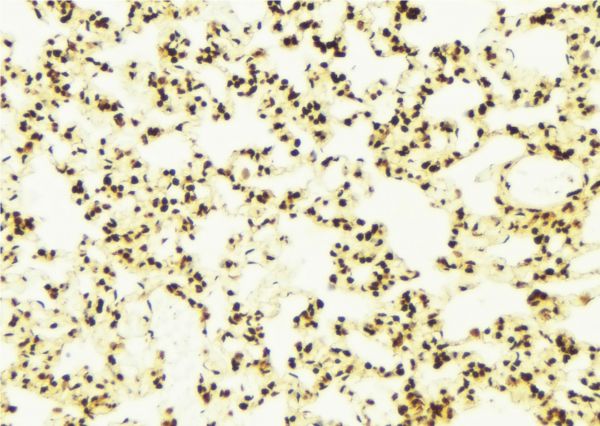 STK9 / CDKL5 Antibody - 1:100 staining mouse lung tissue by IHC-P. The sample was formaldehyde fixed and a heat mediated antigen retrieval step in citrate buffer was performed. The sample was then blocked and incubated with the antibody for 1.5 hours at 22°C. An HRP conjugated goat anti-rabbit antibody was used as the secondary.