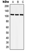 STK9 / CDKL5 Antibody - Western blot analysis of CDKL5 expression in HEK293T (A); Raw264.7 (B); PC12 (C) whole cell lysates.