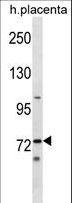STKLD1 / SgK071 Antibody - Mouse Sgk071 Antibody western blot of human placenta tissue lysates (35 ug/lane). The Mouse Sgk071 antibody detected the Mouse Sgk071 protein (arrow).