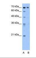 STKLD1 / SgK071 Antibody - Lane A: Marker. Lane B: HepG2 cell lysate. Antibody concentration: 2.5 ug/ml. Gel concentration: 12%.  This image was taken for the unconjugated form of this product. Other forms have not been tested.