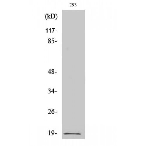 STMN1 / Stathmin / LAG Antibody - Western blot of Phospho-Op18 (S16) antibody