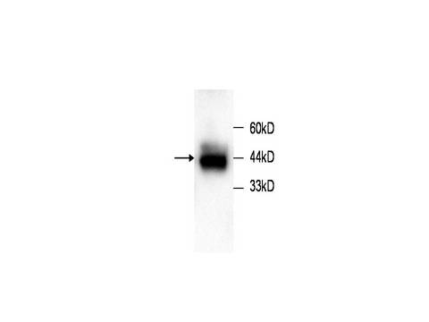 STMN1 / Stathmin / LAG Antibody