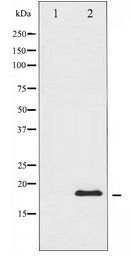 STMN1 / Stathmin / LAG Antibody - Western blot of Stathmin 1 expression in COS7 whole cell lysates,The lane on the left is treated with the antigen-specific peptide.