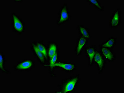 STMN1 / Stathmin / LAG Antibody - Immunofluorescent analysis of Hela cells using STMN1 Antibody at dilution of 1:100 and Alexa Fluor 488-congugated AffiniPure Goat Anti-Rabbit IgG(H+L)