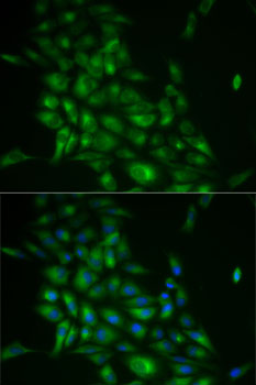 STMN1 / Stathmin / LAG Antibody - Immunofluorescence analysis of HeLa cells using STMN1 antibody. Blue: DAPI for nuclear staining.