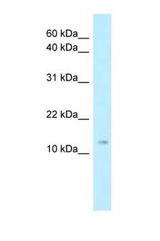 STMN1 / Stathmin / LAG Antibody - STMN1 antibody Western blot of Mouse Thymus lysate. Antibody concentration 1 ug/ml.  This image was taken for the unconjugated form of this product. Other forms have not been tested.