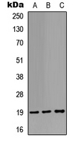 STMN1 / Stathmin / LAG Antibody - Western blot analysis of STMN1 expression in HEK293T (A); HeLa (B); rat muscle (C) whole cell lysates.