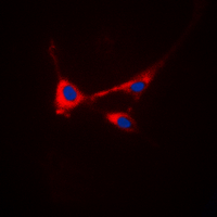 STMN1 / Stathmin / LAG Antibody - Immunofluorescent analysis of STMN1 (pS25) staining in HeLa cells. Formalin-fixed cells were permeabilized with 0.1% Triton X-100 in TBS for 5-10 minutes and blocked with 3% BSA-PBS for 30 minutes at room temperature. Cells were probed with the primary antibody in 3% BSA-PBS and incubated overnight at 4 deg C in a humidified chamber. Cells were washed with PBST and incubated with a DyLight 594-conjugated secondary antibody (red) in PBS at room temperature in the dark. DAPI was used to stain the cell nuclei (blue).