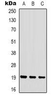 STMN1 / Stathmin / LAG Antibody - Western blot analysis of STMN1 (pS16) expression in HEK293T (A); HeLa (B); Jurkat (C) whole cell lysates.