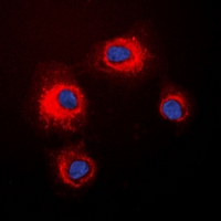 STMN1 / Stathmin / LAG Antibody - Immunofluorescent analysis of STMN1 (pS16) staining in HeLa cells. Formalin-fixed cells were permeabilized with 0.1% Triton X-100 in TBS for 5-10 minutes and blocked with 3% BSA-PBS for 30 minutes at room temperature. Cells were probed with the primary antibody in 3% BSA-PBS and incubated overnight at 4 deg C in a humidified chamber. Cells were washed with PBST and incubated with a DyLight 594-conjugated secondary antibody (red) in PBS at room temperature in the dark. DAPI was used to stain the cell nuclei (blue).