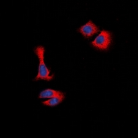 STMN1 / Stathmin / LAG Antibody - Immunofluorescent analysis of STMN1 staining in HeLa cells. Formalin-fixed cells were permeabilized with 0.1% Triton X-100 in TBS for 5-10 minutes and blocked with 3% BSA-PBS for 30 minutes at room temperature. Cells were probed with the primary antibody in 3% BSA-PBS and incubated overnight at 4 deg C in a humidified chamber. Cells were washed with PBST and incubated with a DyLight 594-conjugated secondary antibody (red) in PBS at room temperature in the dark. DAPI was used to stain the cell nuclei (blue).