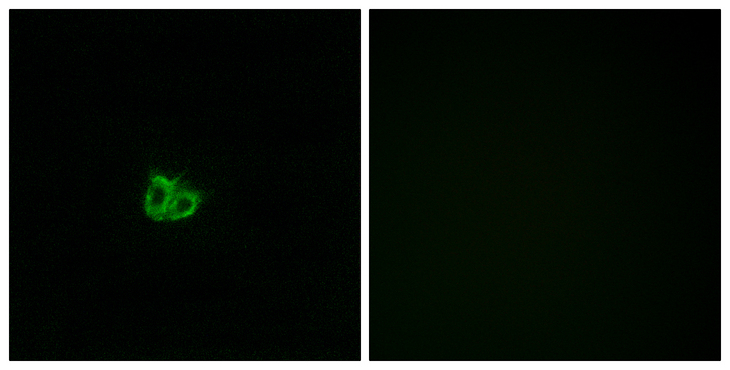 STMN1 / Stathmin / LAG Antibody - Immunofluorescence analysis of COS7 cells, using Stathmin 1 (Phospho-Ser15) Antibody. The picture on the right is blocked with the phospho peptide.