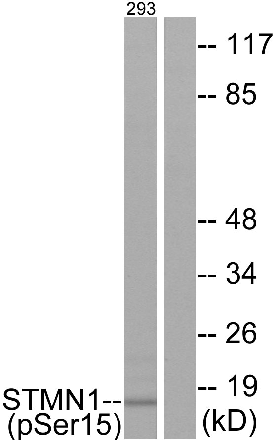 STMN1 / Stathmin / LAG Antibody - Western blot analysis of lysates from 293 cells, using Stathmin 1 (Phospho-Ser15) Antibody. The lane on the right is blocked with the phospho peptide.
