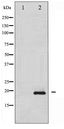 STMN1 / Stathmin / LAG Antibody - Western blot of Stathmin 1 phosphorylation expression in 293 whole cell lysates,The lane on the left is treated with the antigen-specific peptide.