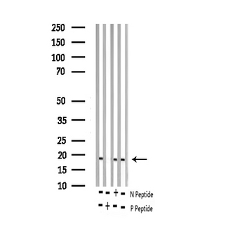 STMN1 / Stathmin / LAG Antibody - Western blot analysis of Phospho-Stathmin 1 (Ser15) expression in various lysates