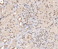 STMN1 / Stathmin / LAG Antibody - 1:200 staining human kidney tissue by IHC-P. The tissue was formaldehyde fixed and a heat mediated antigen retrieval step in citrate buffer was performed. The tissue was then blocked and incubated with the antibody for 1.5 hours at 22°C. An HRP conjugated goat anti-rabbit antibody was used as the secondary.
