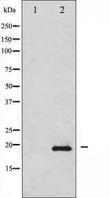 STMN1 / Stathmin / LAG Antibody - Western blot analysis of Stathmin 1 phosphorylation expression in 293 whole cells lysates. The lane on the left is treated with the antigen-specific peptide.