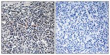 STMN1 / Stathmin / LAG Antibody - P-peptide - + Immunohistochemistry analysis of paraffin-embedded human thymus gland tissue using Stathmin 1 (Phospho-Ser15) antibody.