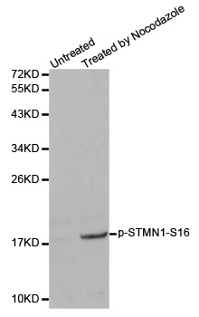 STMN1 / Stathmin / LAG Antibody - Western blot analysis of extracts from 293 cells.