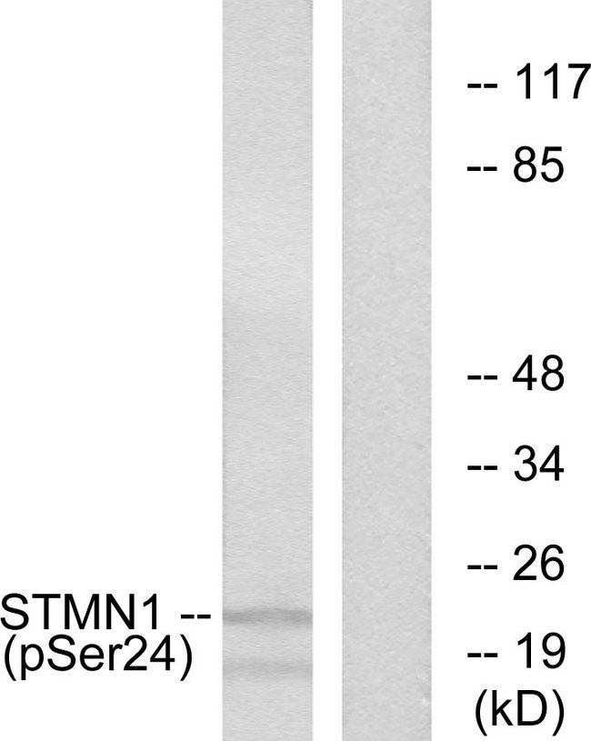 STMN1 / Stathmin / LAG Antibody - Western blot analysis of lysates from Jurkat cells treated with PMA 1ng/ml 15', using Stathmin 1 (Phospho-Ser24) Antibody. The lane on the right is blocked with the phospho peptide.