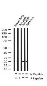 STMN1 / Stathmin / LAG Antibody - Western blot analysis of Phospho-Stathmin 1 (Ser24) expression in various lysates