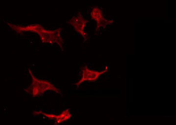 STMN1 / Stathmin / LAG Antibody - Staining HeLa cells by IF/ICC. The samples were fixed with PFA and permeabilized in 0.1% Triton X-100, then blocked in 10% serum for 45 min at 25°C. The primary antibody was diluted at 1:200 and incubated with the sample for 1 hour at 37°C. An Alexa Fluor 594 conjugated goat anti-rabbit IgG (H+L) Ab, diluted at 1/600, was used as the secondary antibody.