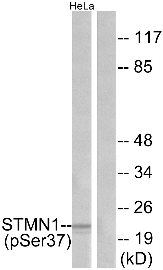 STMN1 / Stathmin / LAG Antibody - Western blot analysis of lysates from HeLa cells treated with nocodazole, using Stathmin 1 (Phospho-Ser37) Antibody. The lane on the right is blocked with the phospho peptide.